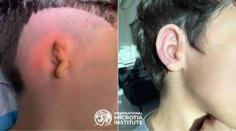 Before & after — Case 01