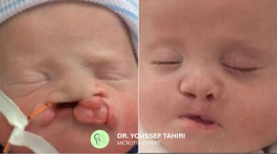 Before & After result