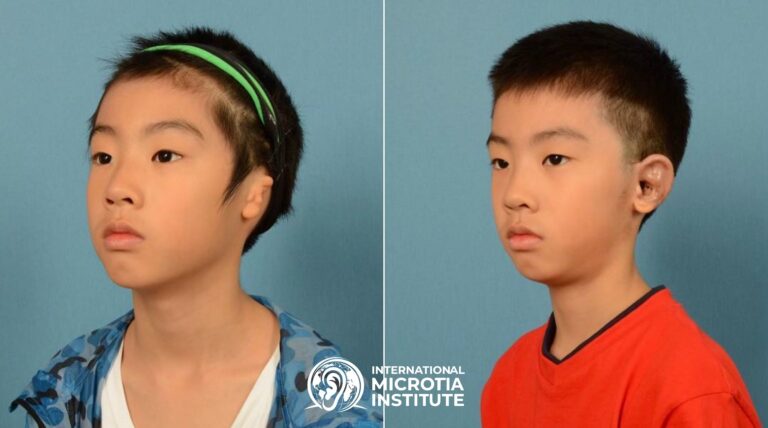 Before & after — Case 06