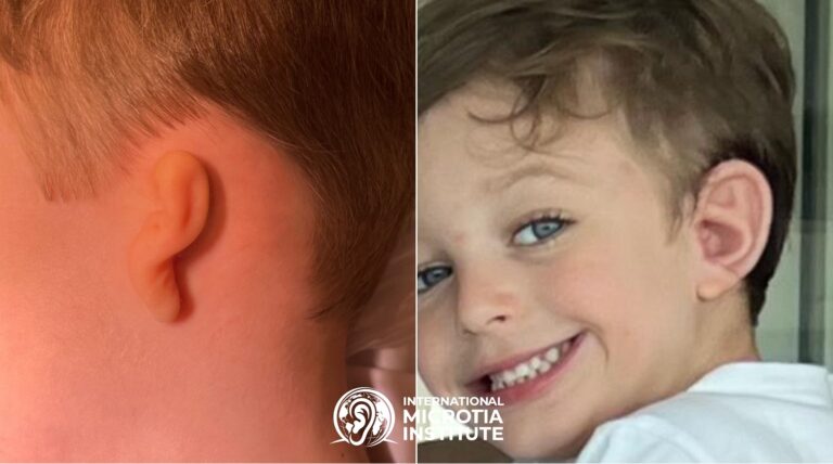 Before & after — Case 03