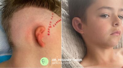 Before & After result