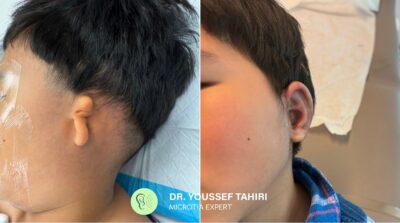 Before & After result