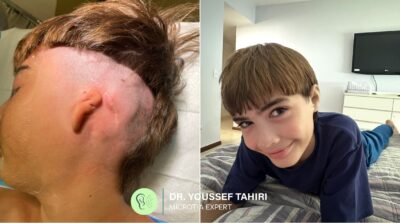 Before & After result