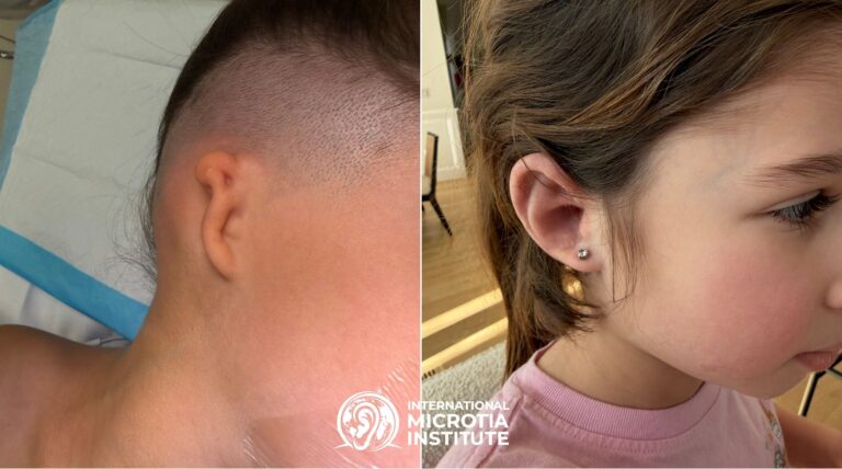 Before & after — Case 02