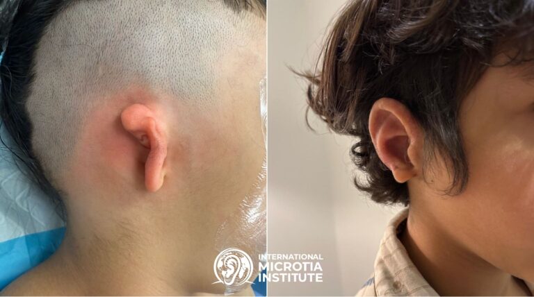 Before & after — Case 04