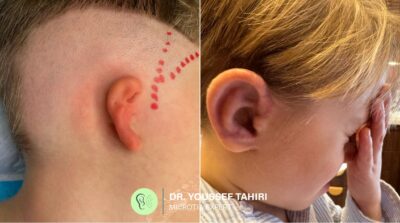 Before & After result