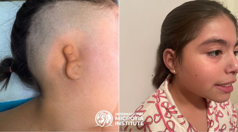 Before & after — Case 05