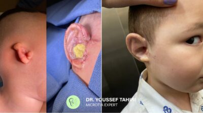 Before & After result