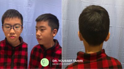 Before & After result