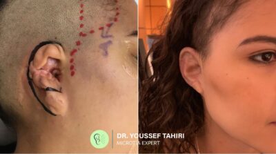 Before & After result