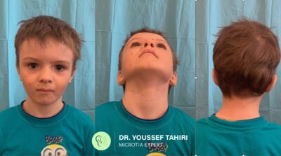 Before & After result