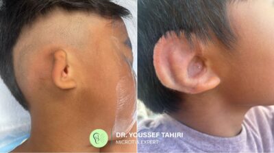 Before & After result
