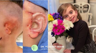 Before & After result