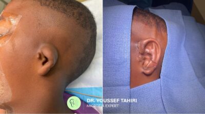 Before & After result