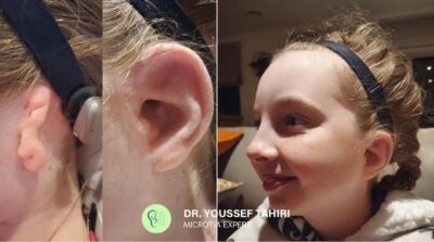 Before & After result