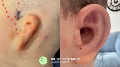 Before & After result