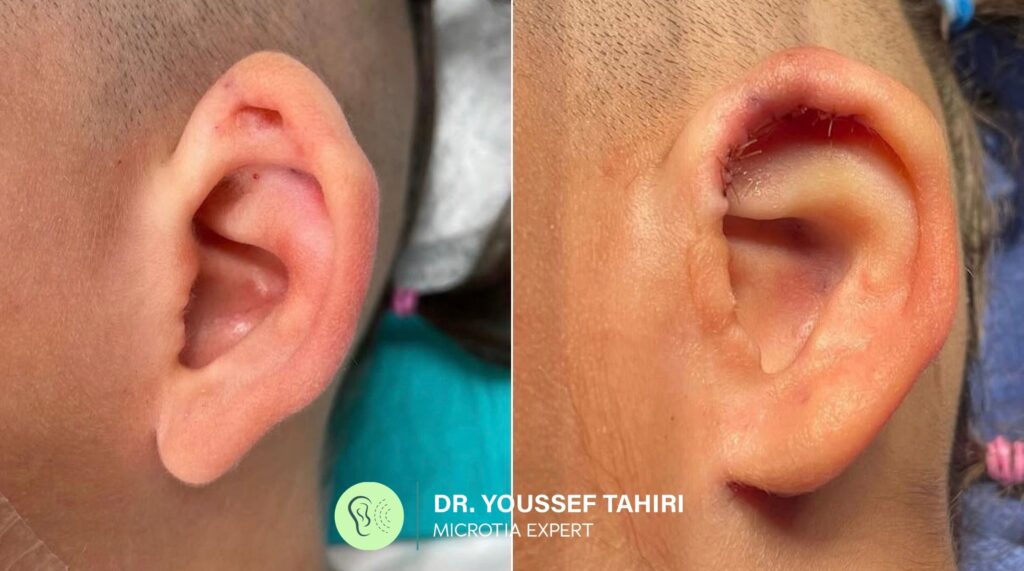 Before & After result