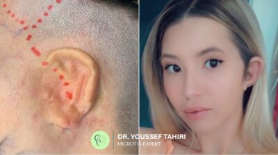 Before & After result