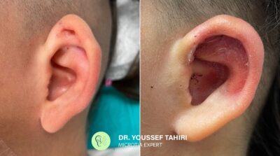 Before & After result