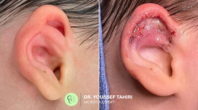 Before & After result