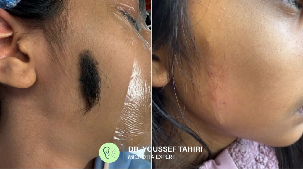 Before & After result