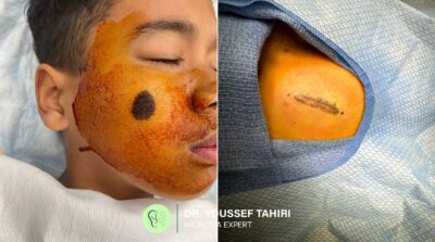 Before & After result