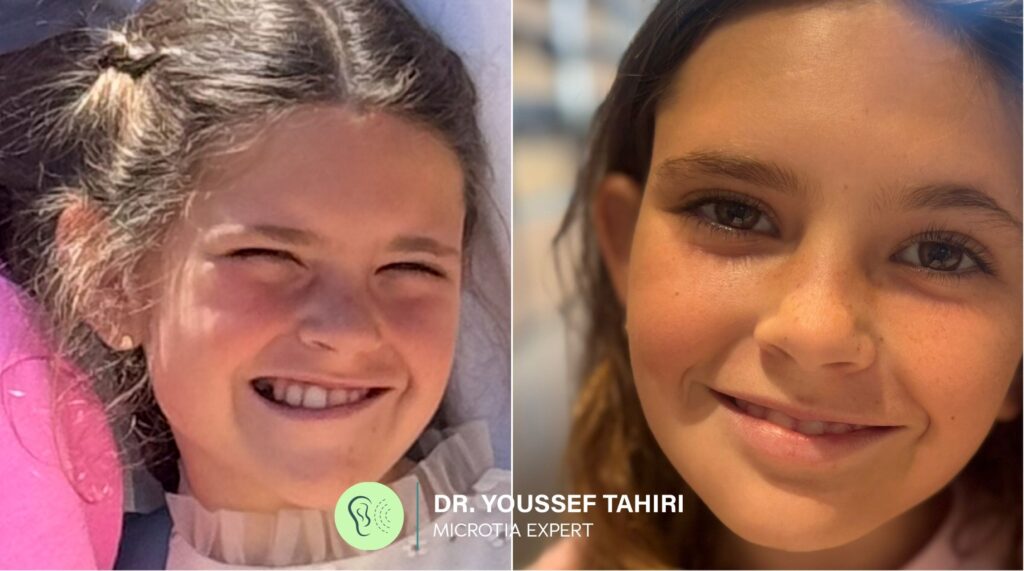 Before & After result