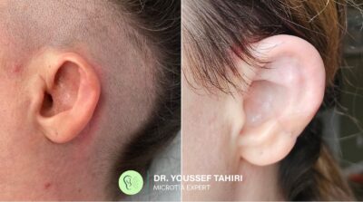 Before & After result