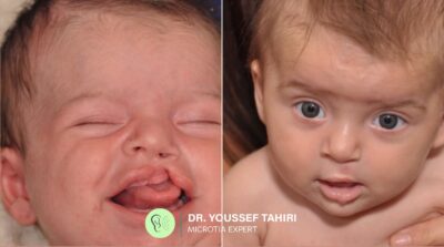Before & After result