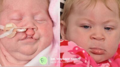 Before & After result