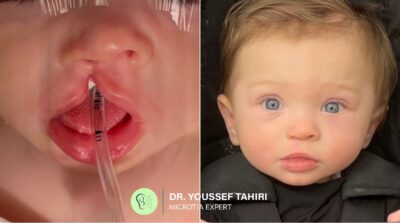 Before & After result
