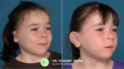 Before & After result