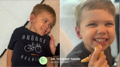 Before & After result