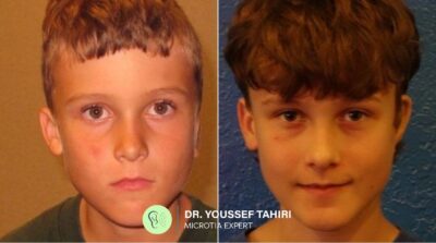 Before & After result