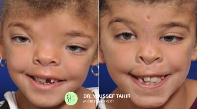 Before & After result