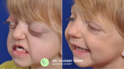 Before & After result