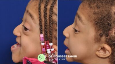 Before & After result