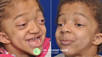 Before & After result