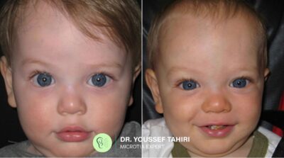 Before & After result
