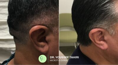 Before & After result