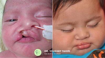 Before & After result