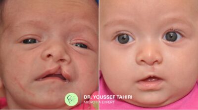 Before & After result