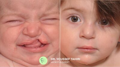 Before & After result