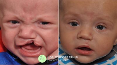 Before & After result