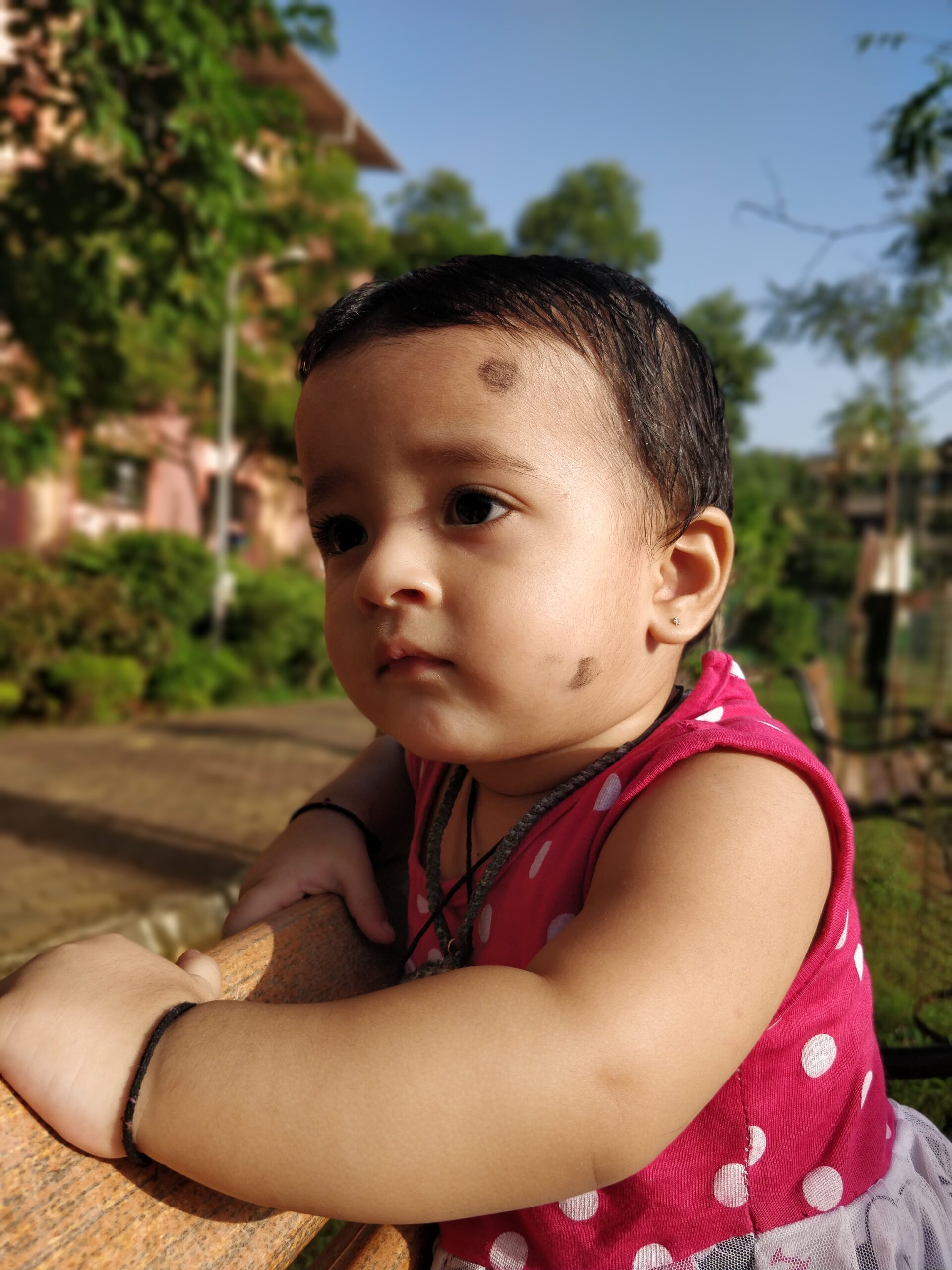 Baby girl outdoors with small dark birthmarks on her forehead and cheek