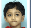 Long-term results of SUPOR™ Ear Reconstruction – a 20-year follow-up.